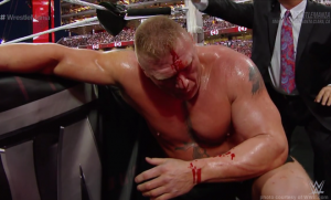 Brock-Lesnar-bloodied-660x400