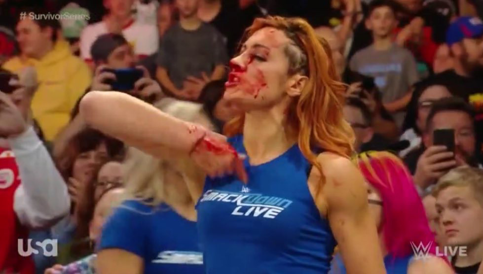 becky-lynch-comments-on-getting-busted-open-on-wwe-raw